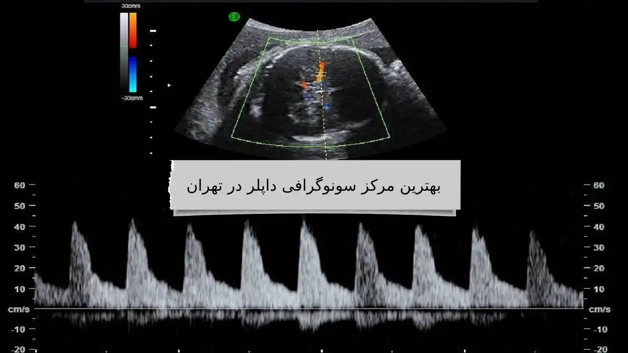بهترین مرکز سونوگرافی داپلر در تهران