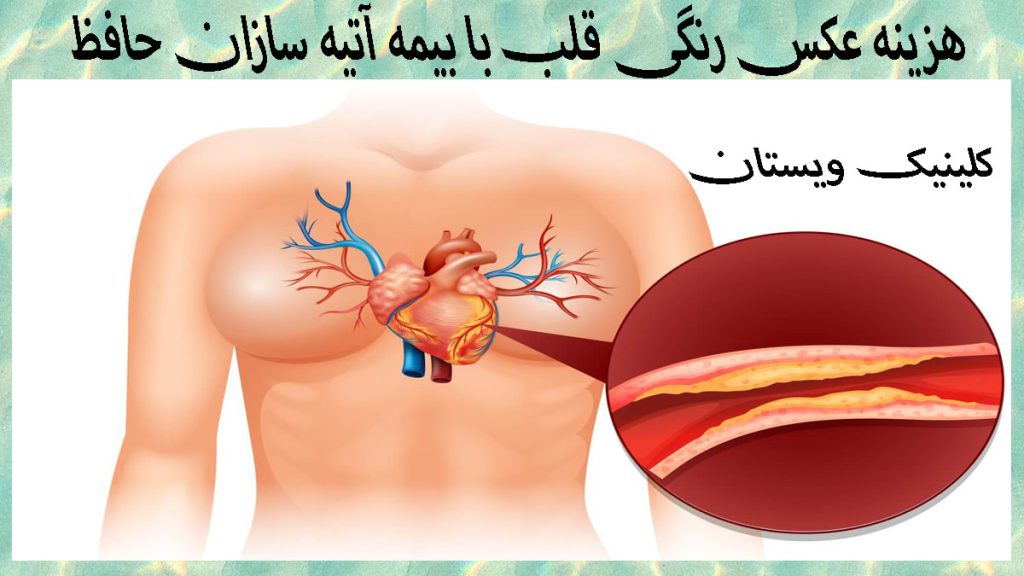 هزینه عکس رنگی قلب با بیمه تصویری بزرگ نمایی شده از رگ قلب یک شخص که دچار گرفتگی شده