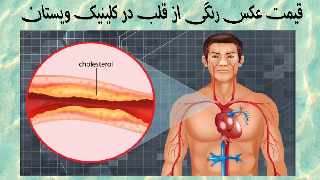 قیمت عکس رنگی از قلب تصویری انیمیشنی از یک آقا رد سمت راست و تصویر بزرگنمایی شده از رگهای قلب او