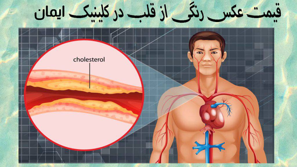 تصویری بزرگ نمایی شده از رگ قلب یک شخص که دچار گرفتگی شده