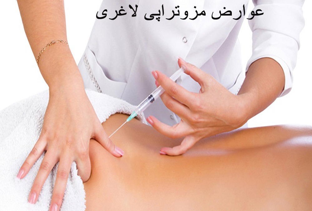 عوارض مزوتراپی لاغری شکم
