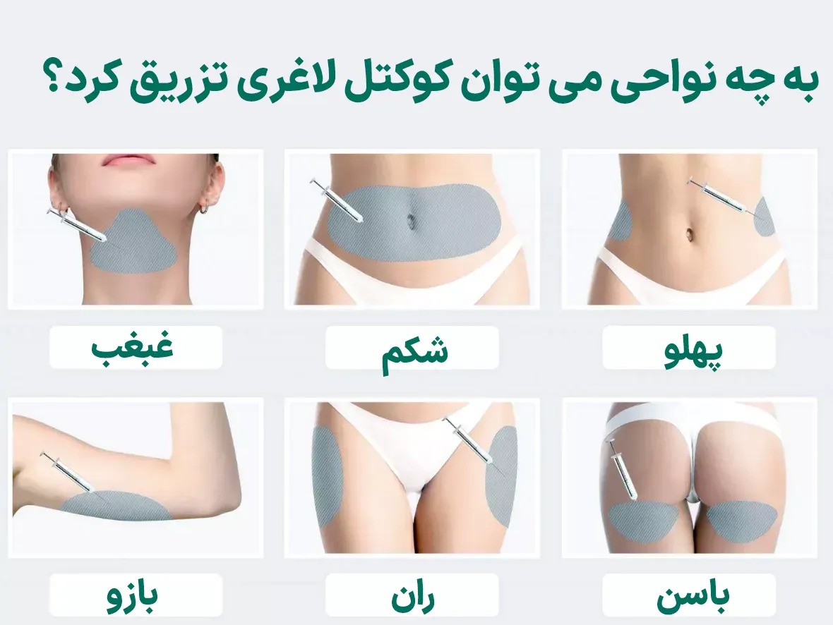 تزریق کوکتل نواحی قابل تزریق برای کوکتل