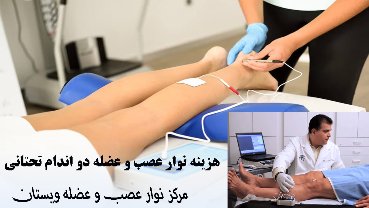 دو تصویر از نوار عصب و عضله پا