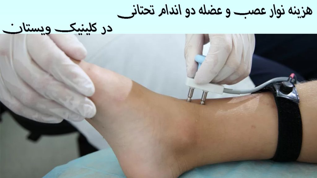 هزینه نوار عصب و عضله یک پزشک درر حال انجام نوار عصب و عضله پا -نوشته با عنوان هزینه نوار عصب و عضله دو اندام تحتانی