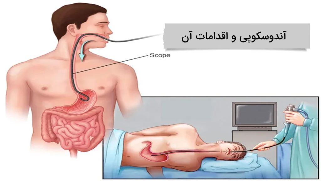 اندوسکوپی و اقدامات لازم برای آن