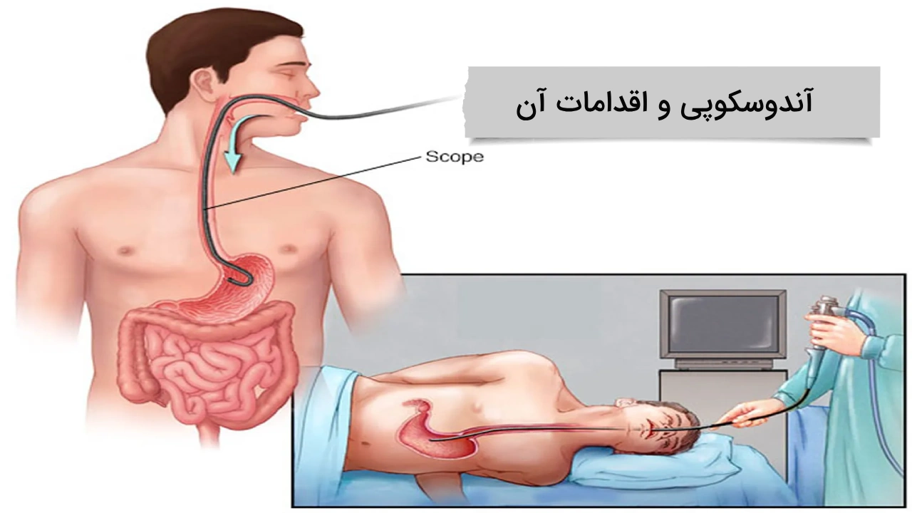اندوسکوپی و اقدامات لازم برای آن