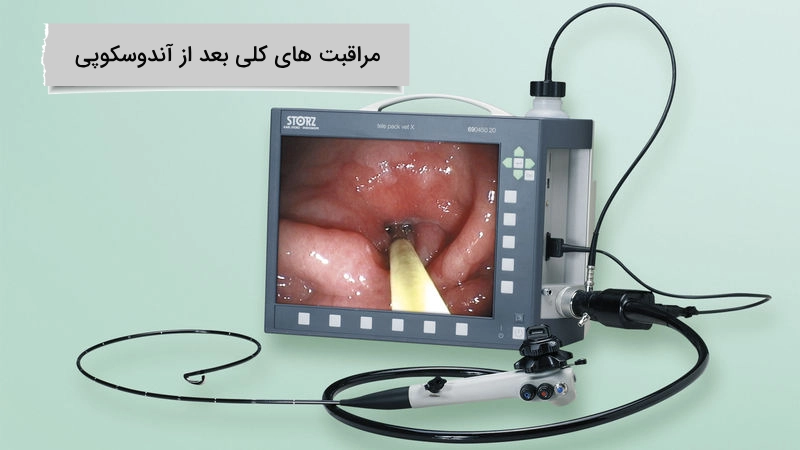 مراقبت های کلی بعد از اندوسکوپی به طور کلی چه مراقبت هایی باید پس از اندوسکوپی انجام شود