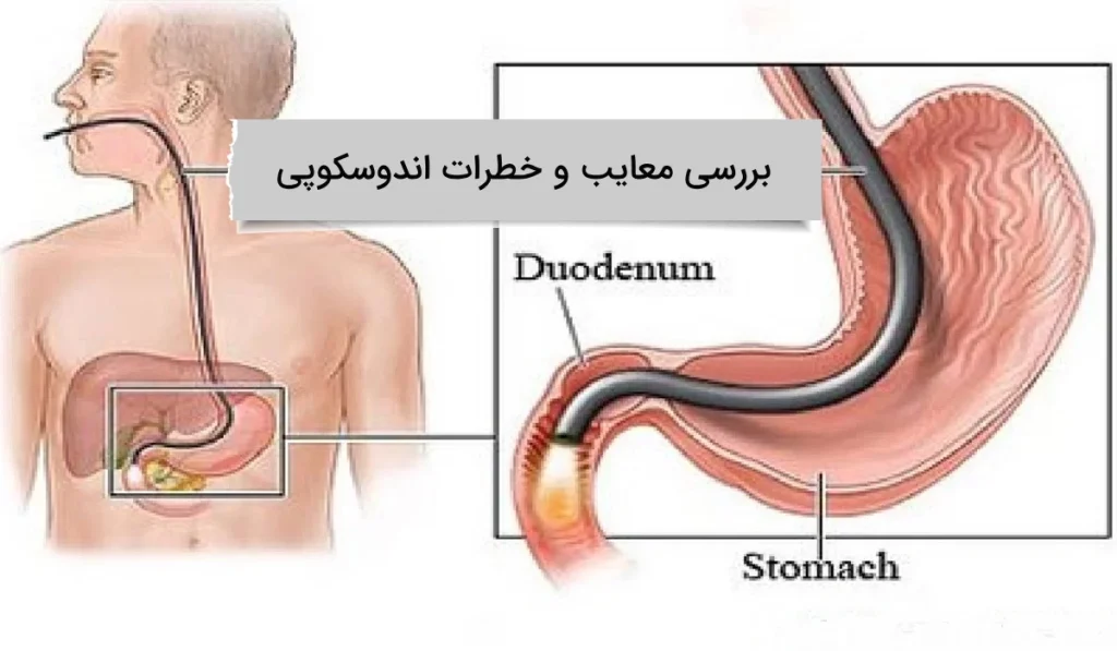 خطرات اندوسکوپی چیست؟