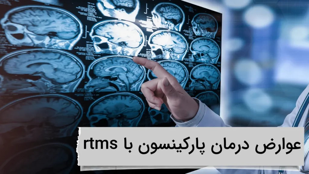 عوارض درمان پارکینسون با rtms