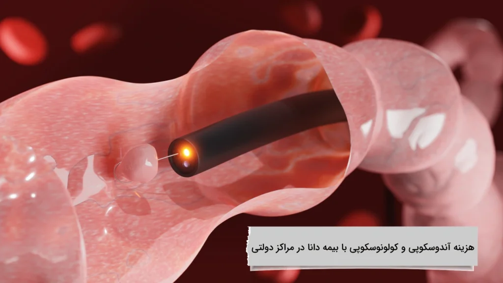 هزینه آندوسکوپی و کولونوسکوپی با بیمه دانا در مراکز دولتی پوشش تمامی نکات درباره هزینه آندوسکوپی و کولونوسکوپی با بیمه دانا در مراکز دولتی