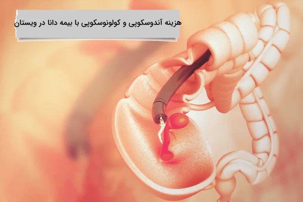هزینه آندوسکوپی و کولونوسکوپی با بیمه دانا در ویستان اگاهی کامل هزینه آندوسکوپی و کولونوسکوپی با بیمه دانا در ویستان
