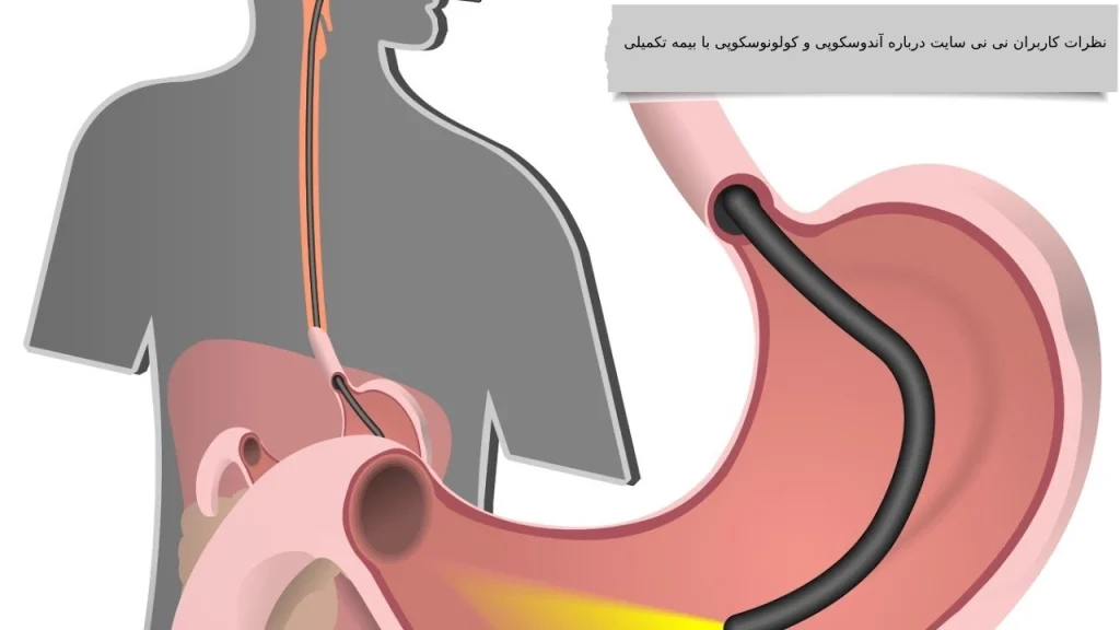 شرح کامل هزینه آندوسکوپی و کولونوسکوپی با بیمه تکمیلی در مراکز دولتی و خصوصی