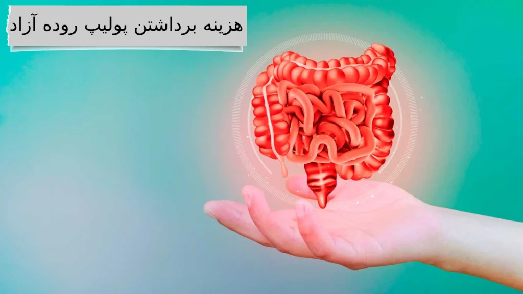 هزینه برداشتن پولیپ روده آزاد جزئیات کامل هزینه برداشتن پولیپ روده با انواع بیمه ها