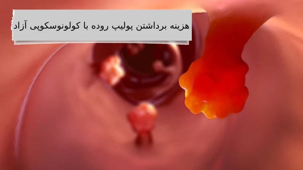 همراه ما دانستن بهترین هزینه برداشتن پولیپ روده با کولونوسکوپی کاری نداره!