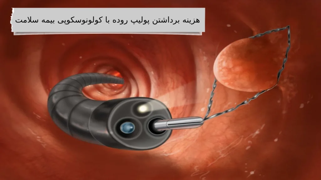 همراه ما دانستن بهترین هزینه برداشتن پولیپ روده با کولونوسکوپی کاری نداره!
