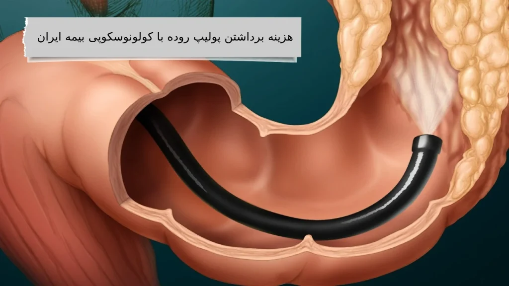 همراه ما دانستن بهترین هزینه برداشتن پولیپ روده با کولونوسکوپی کاری نداره!