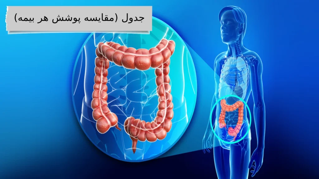 همراه ما دانستن بهترین هزینه برداشتن پولیپ روده با کولونوسکوپی کاری نداره!