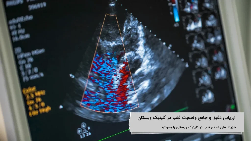 هزینه اسکن قلب در ویستان با بیمه تامین اجتماعی