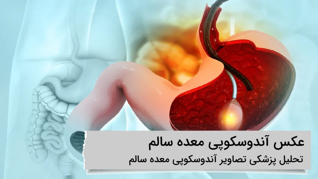 عکس آندوسکوپی معده سالم