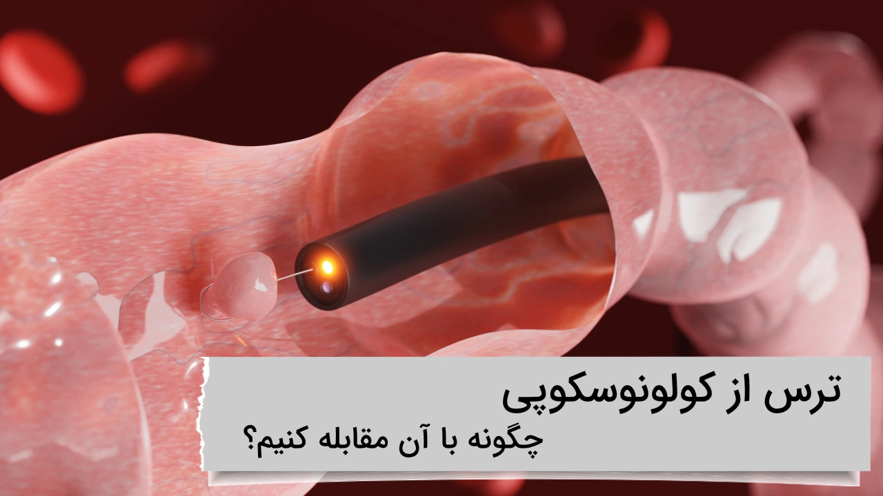 ترس از کولونوسکوپی