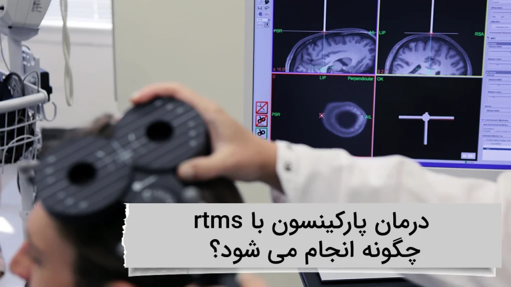 درمان پارکینسون با rtms چگونه انجام می شود؟