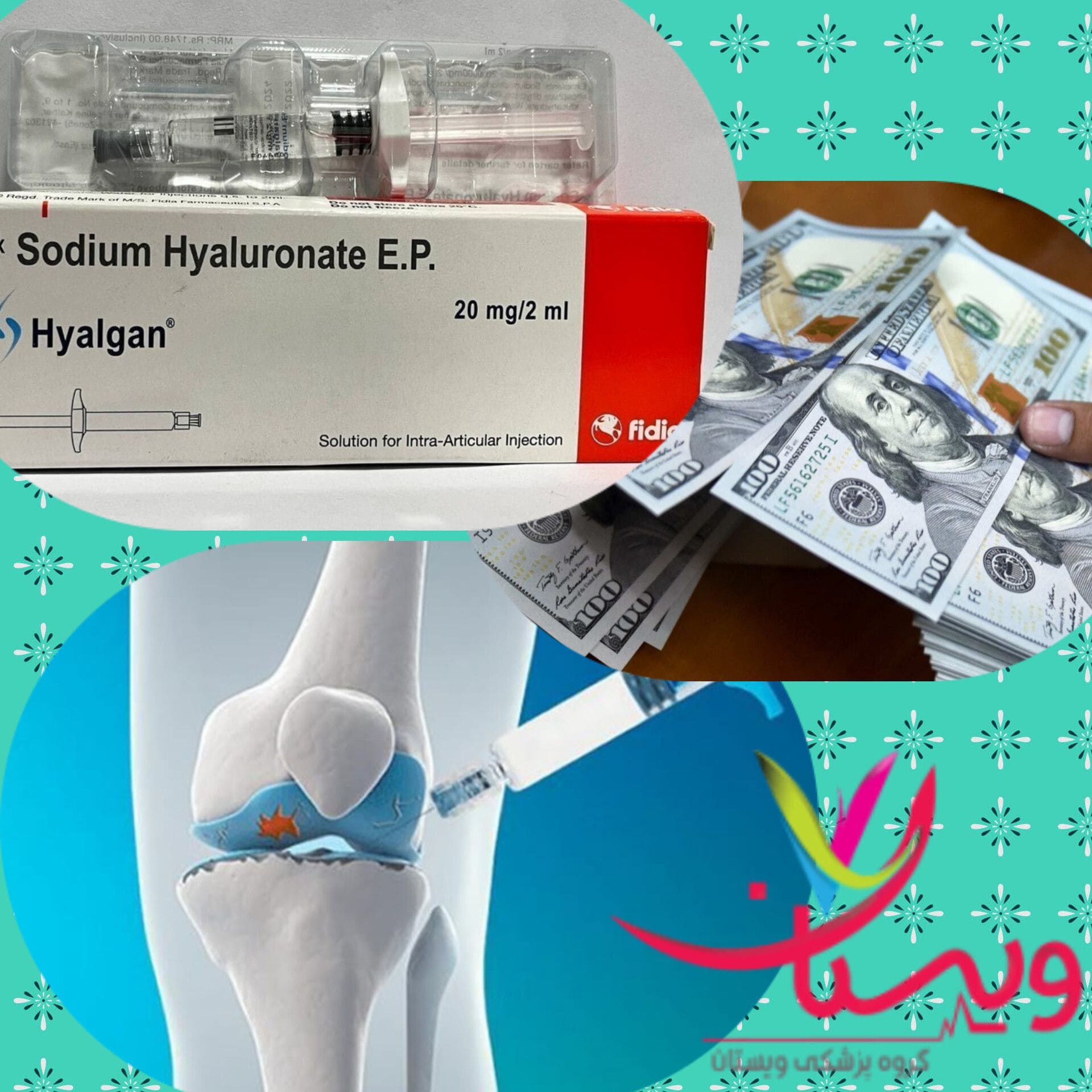 قیمت آمپول هیالگان+3 قیمت آمپول هیالورونیک اسید برای زانو