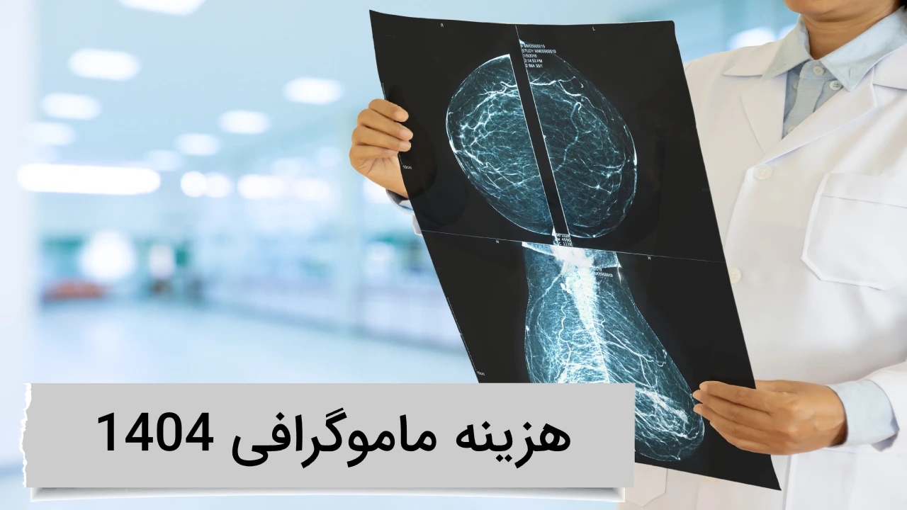 هزینه ماموگرافی 1404