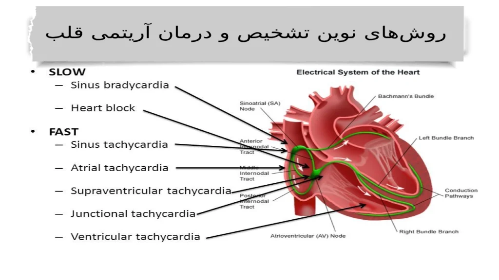 روش‌های نوین تشخیص و درمان آریتمی قلب با بهترین دکتر آریتمی قلبی 