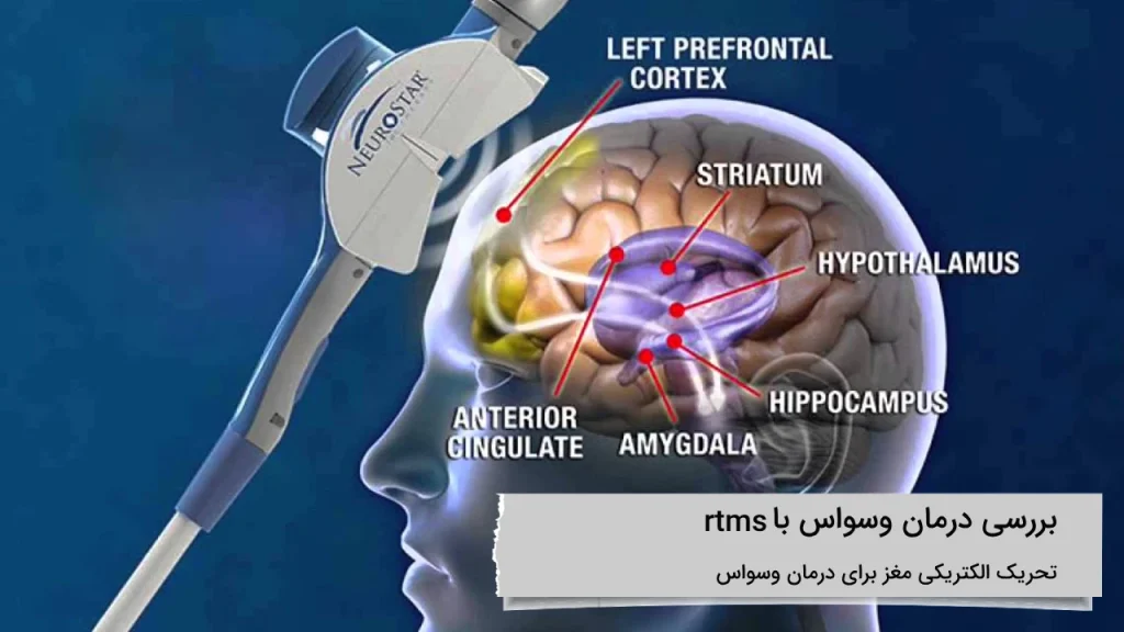 درمان وسواس با rtms