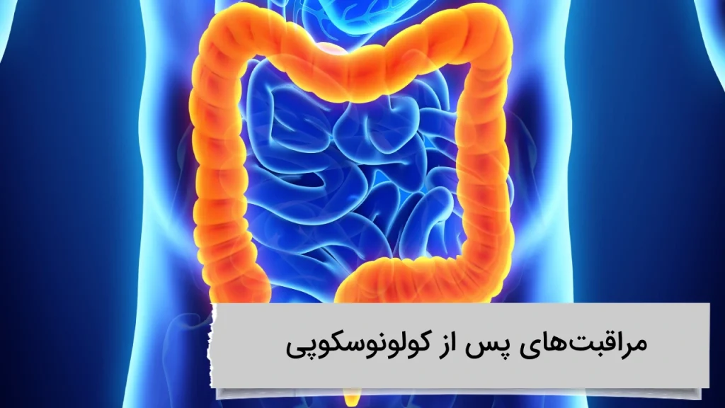 مراقبتهای پس از کولونوسکوپی مراقبتهای پس از کولونوسکوپی