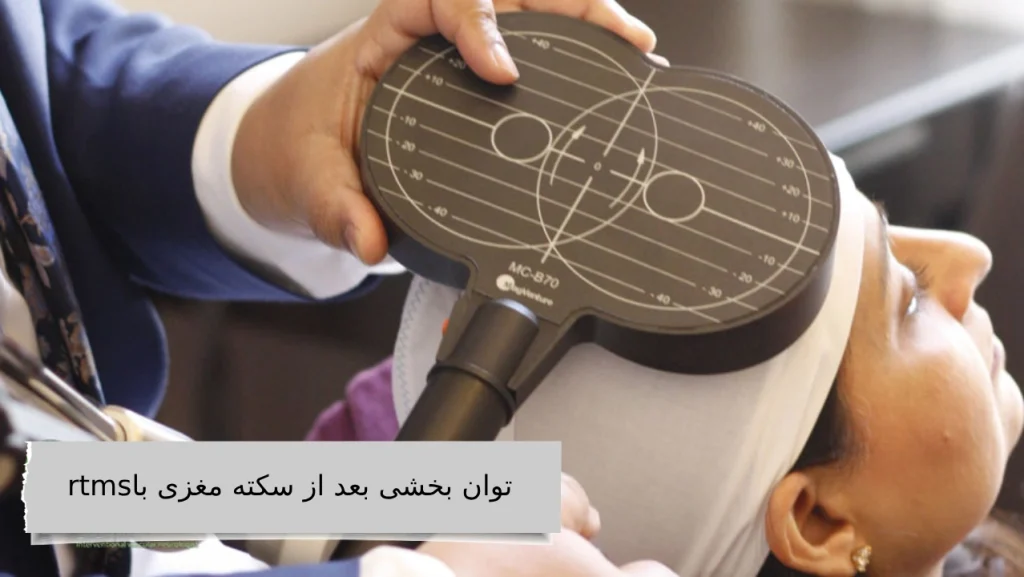 توان بخشی بعد از سکته مغزی با rtms در ویستان توان بخشی بعد از سکته مغزی با rtms در ویستان