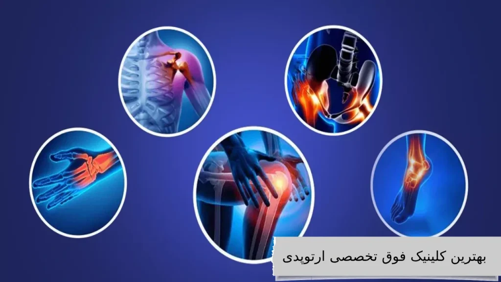 بهترین کلینیک فوق تخصصی ارتوپدی معرفی بهترین کلینیک فوق تخصصی ارتوپدی در غرب و شمال تهران