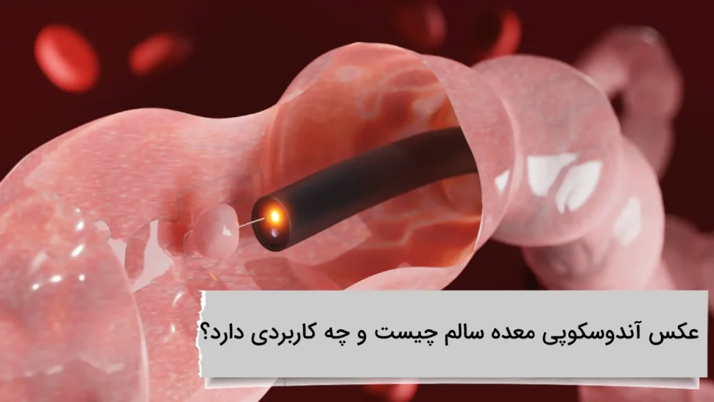 عکس آندوسکوپی معده سالم چیست و چه کاربردی دارد؟