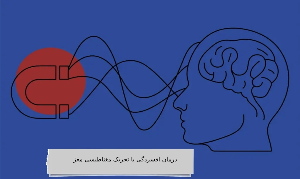 درمان افسردگی با تحریک مغناطیسی مغز