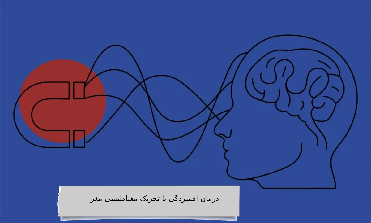 درمان افسردگی با تحریک مغناطیسی مغز