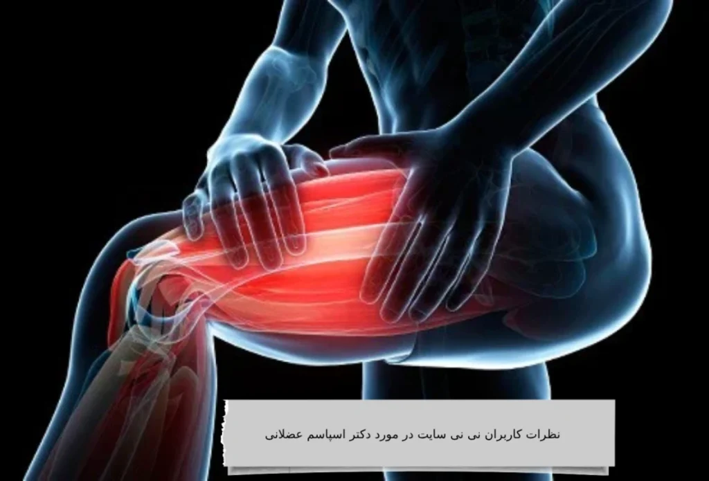 نظرات کاربران نی نی سایت در مورد دکتر اسپاسم عضلانی نظرات کاربران نی نی سایت در مورد دکتر اسپاسم عضلانی