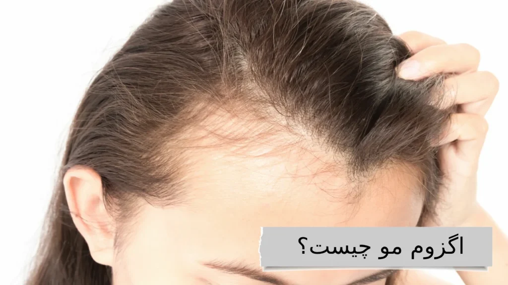 گزوم مو؛ جادوی تناسب و ظرافت، برای موهایی که داستان زیبایی شما را روایت می‌کنند