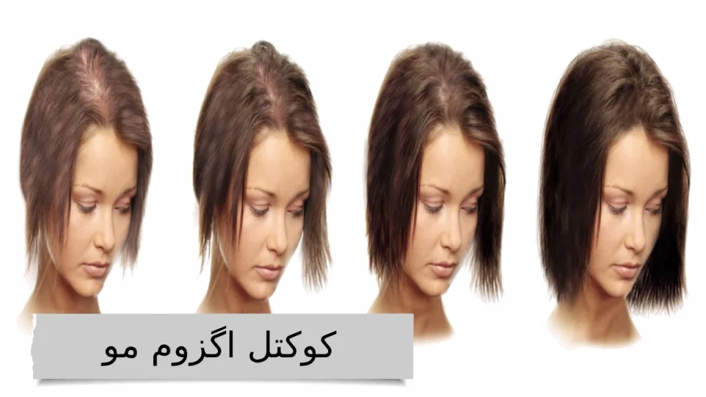 گزوم مو؛ جادوی تناسب و ظرافت، برای موهایی که داستان زیبایی شما را روایت می‌کنند