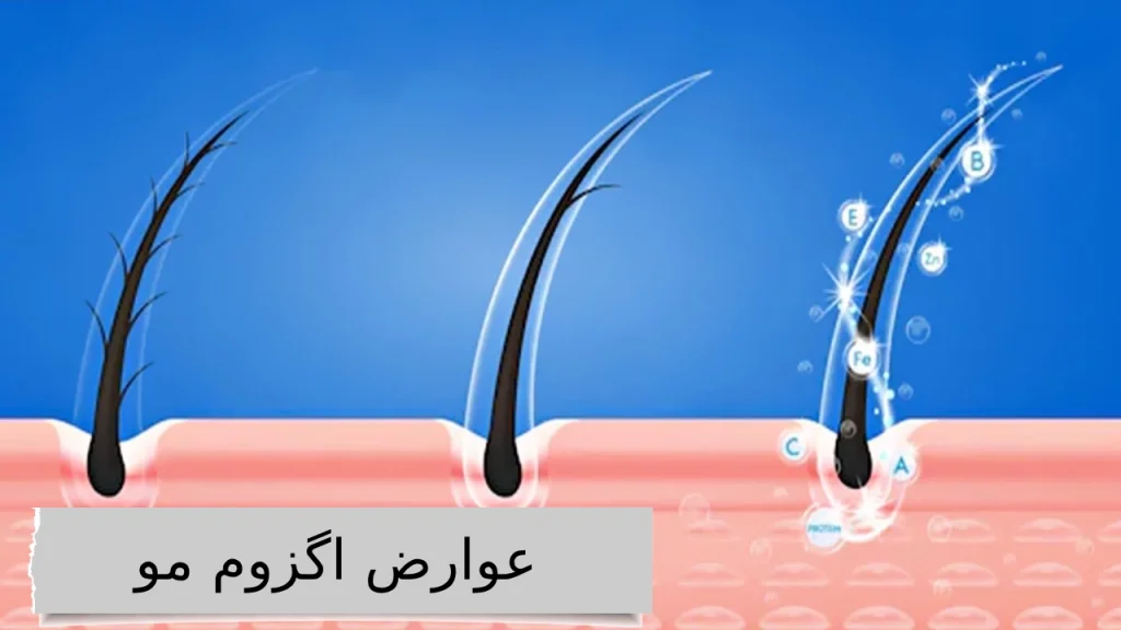 گزوم مو؛ جادوی تناسب و ظرافت، برای موهایی که داستان زیبایی شما را روایت می‌کنند