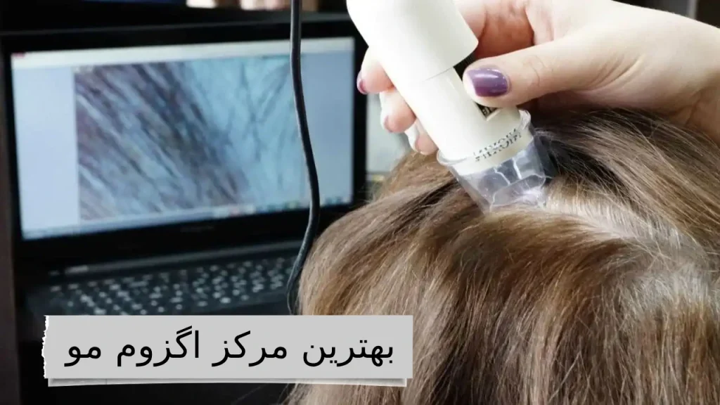 گزوم مو؛ جادوی تناسب و ظرافت، برای موهایی که داستان زیبایی شما را روایت می‌کنند