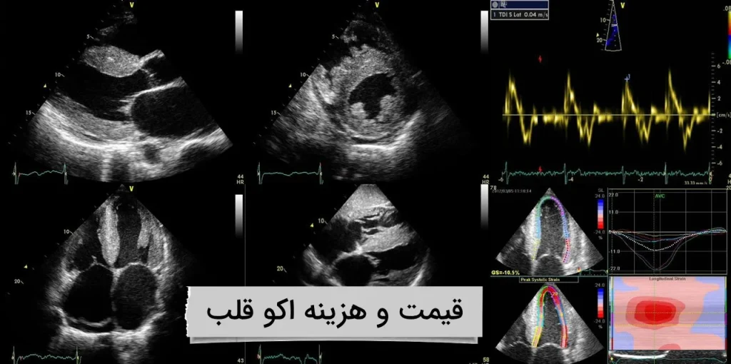 عکس اکو قلب در کلینیک ویستان