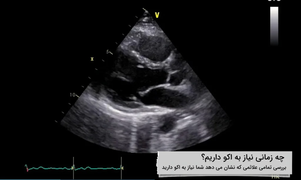 چه زمانی نیاز قلب من نیاز به اکو دارد؟