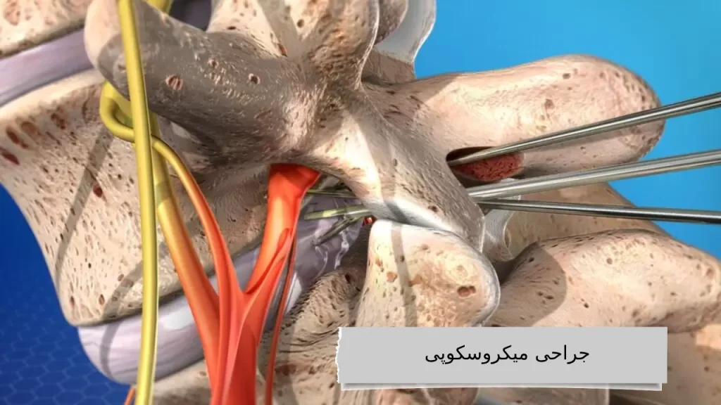 جراحی میکروسکوپی
