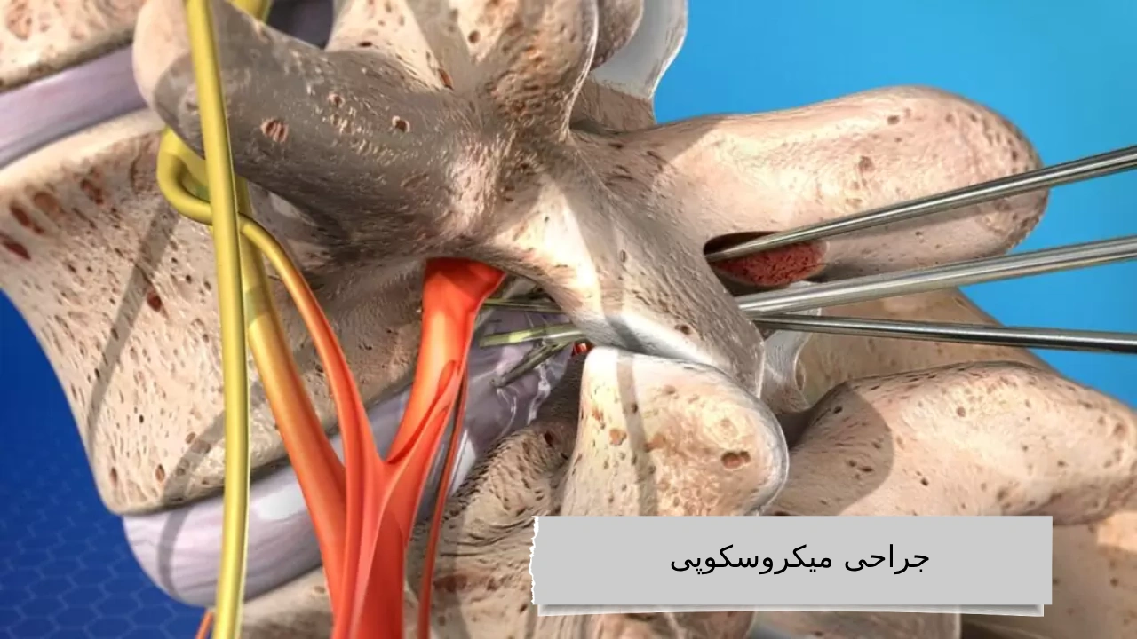 جراحی میکروسکوپی