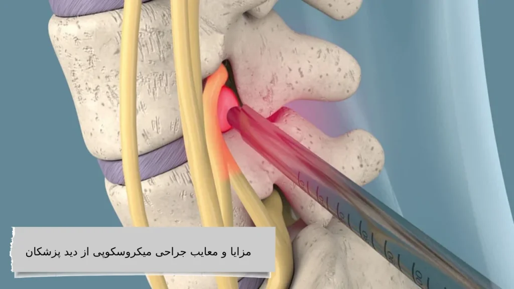 مزایا و معایب جراحی میکروسکوپی از دید پزشکان