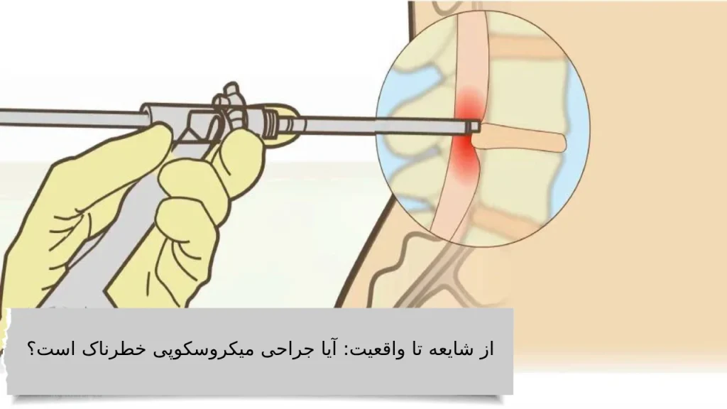 از شایعه تا واقعیت: آیا جراحی میکروسکوپی خطرناک است؟