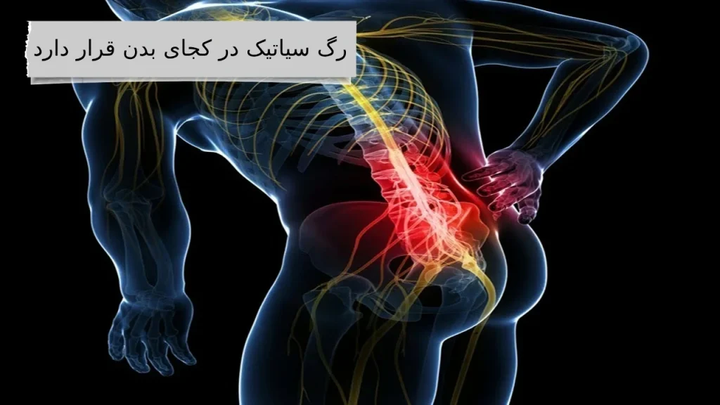 رگ سیاتیک: بزرگراه عصبی بدن شما!