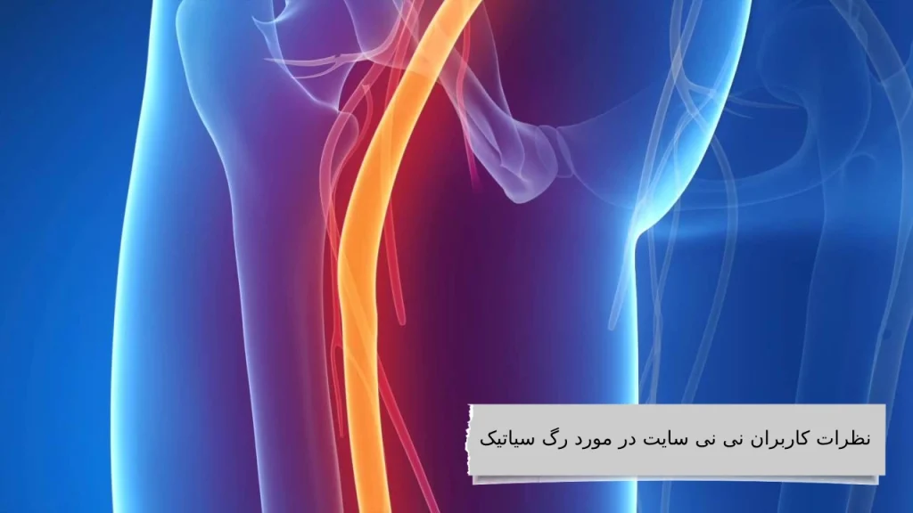 رگ سیاتیک: بزرگراه عصبی بدن شما!