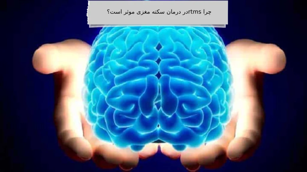 درمان سکته مغزی مؤثر در ویستان چرا rtms در درمان سکته مغزی مؤثر است؟