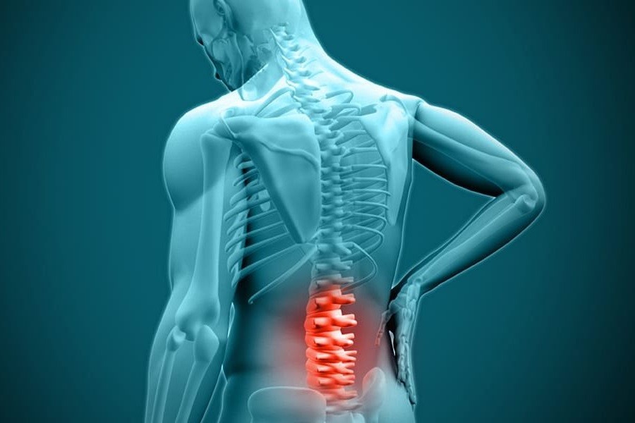 علائم دیسک کمر چیست؟